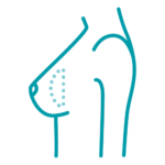 Ein Icon, das die Darstellung einen Implantatwechsel darstellt