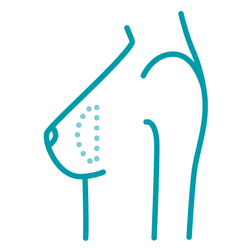 Ein Icon, das die Darstellung einen Implantatwechsel darstellt