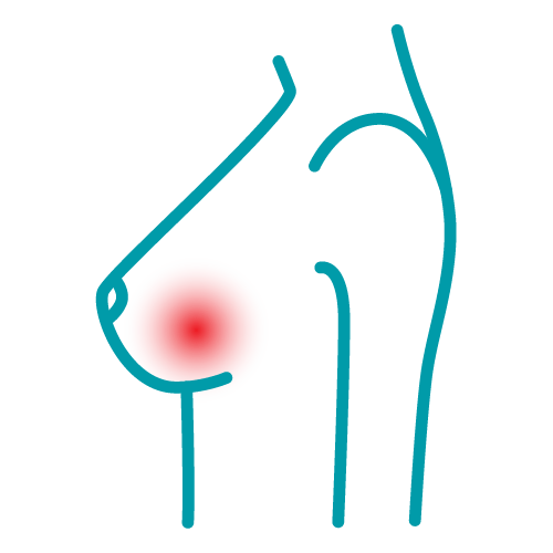 Symbol: Kapselfibrose (Revisionen)
